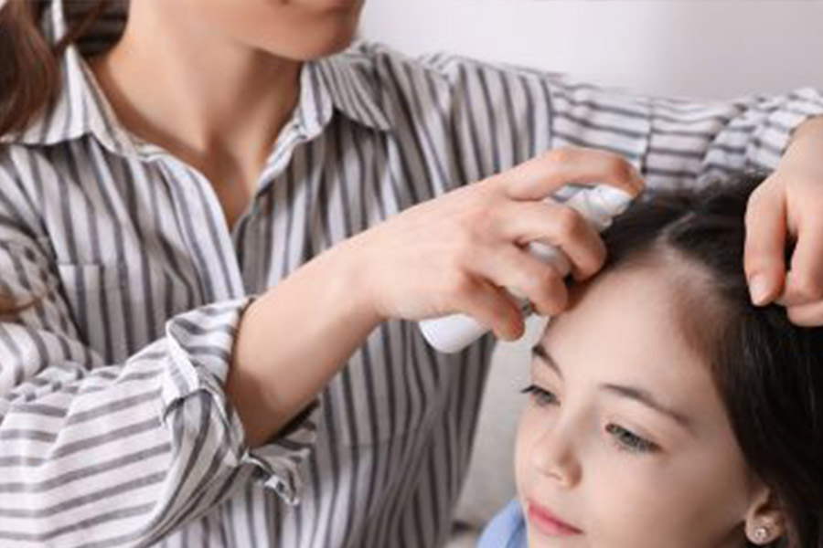ALOPECIA