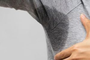 06 Hiperhidrosis destacada